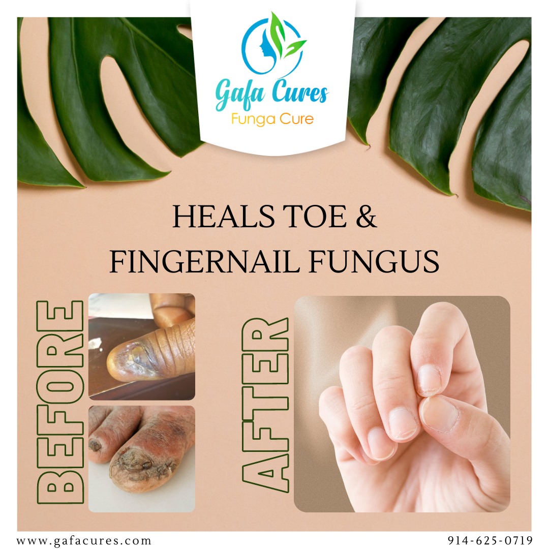 256377209_102834085556238_5798455449064770406_n